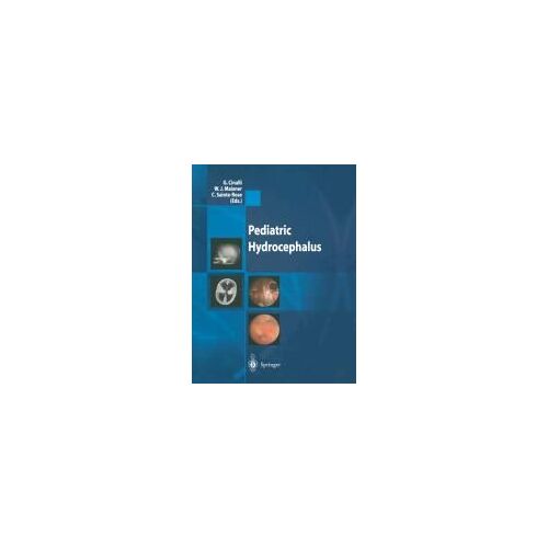 Pediatric Hydrocephalus