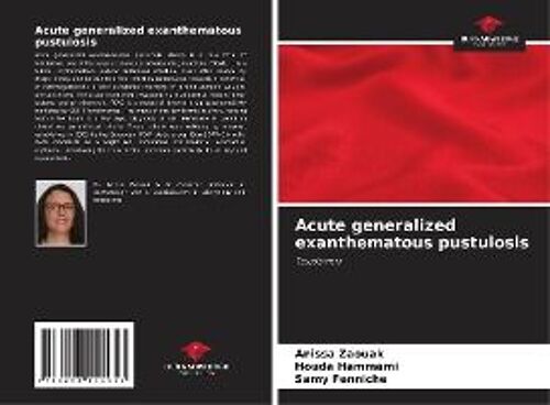 Acute Generalized Exanthematous Pustulosis
