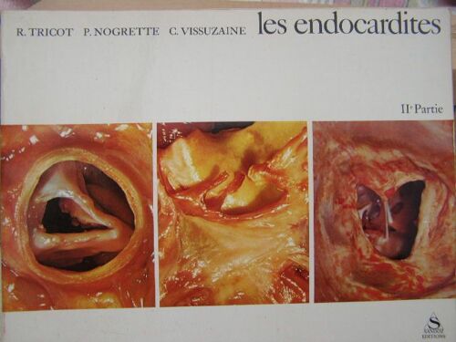 Les Endocardites. (2ème Partie)