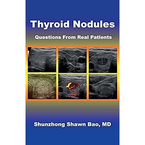Thyroid Nodules: Questions From Real Patients