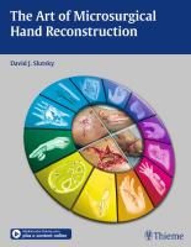 The Art Of Microsurgical Hand Reconstruction