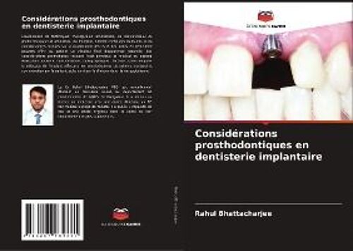 Considérations Prosthodontiques En Dentisterie Implantaire