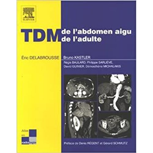 Tdm De L'abdomen Aigu De L'adulte