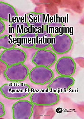 Level Set Method In Medical Imaging Segmentation