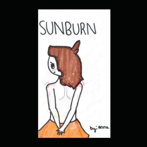 Sunburn: Kid, Always Wear Sunscreen When You Are Outdoors!!!
