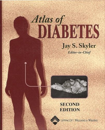 Atlas Of Diabetes - 2nd Edition