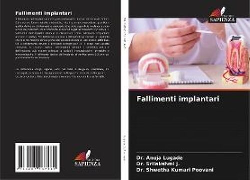 Fallimenti Implantari