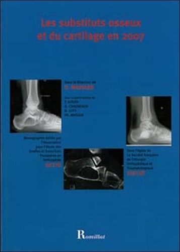 Les Substituts Osseux Et Du Cartilage En 2007
