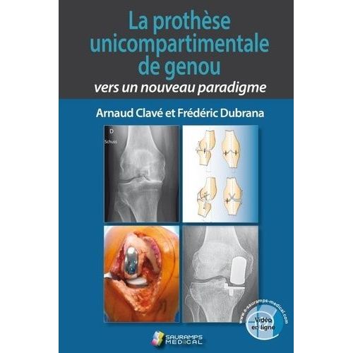 La Prothèse Unicompartimentale De Genou : Vers Un Nouveau Paradigme