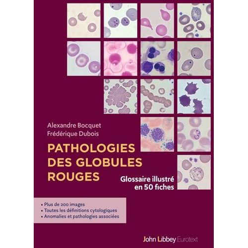 Pathologies Des Globules Rouges - Glossaire Illustré En 50 Fiches