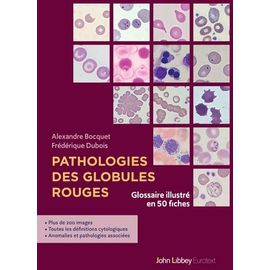 Pathologies Des Globules Rouges - Glossaire Illustré En 50 Fiches