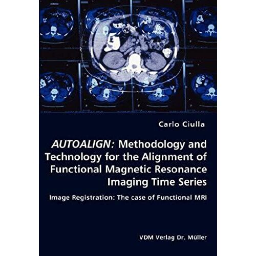Autoalign: Methodology And Technology For The Alignment Of Functional Magnetic Resonance Imaging Time Series