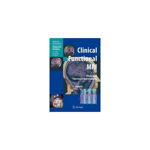 Clinical Functional Mri: Presurgical Functional Neuroimaging