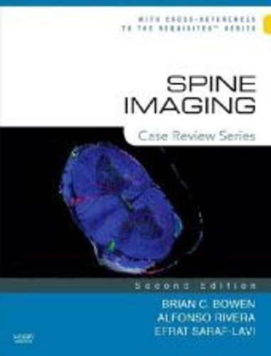 Spine Imaging
