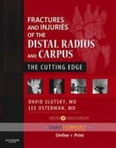 Fractures And Injuries Of The Distal Radius And Carpus: The Cutting Edge [With Access Code]