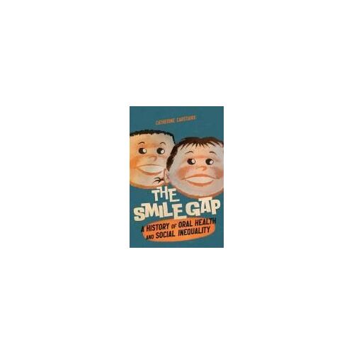 Smile Gap