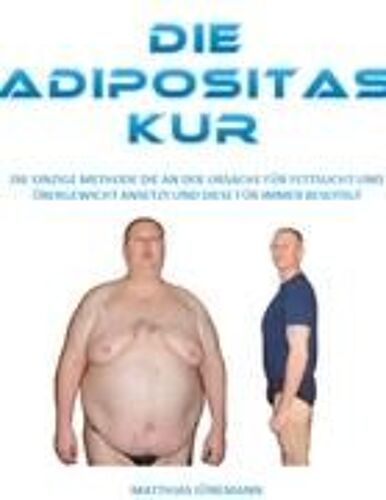Die Adipositas Kur