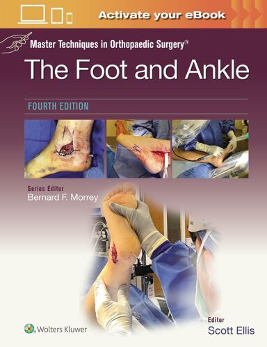 Master Techniques In Orthopaedic Surgery: The Foot And Ankle: Print + Ebook With Multimedia