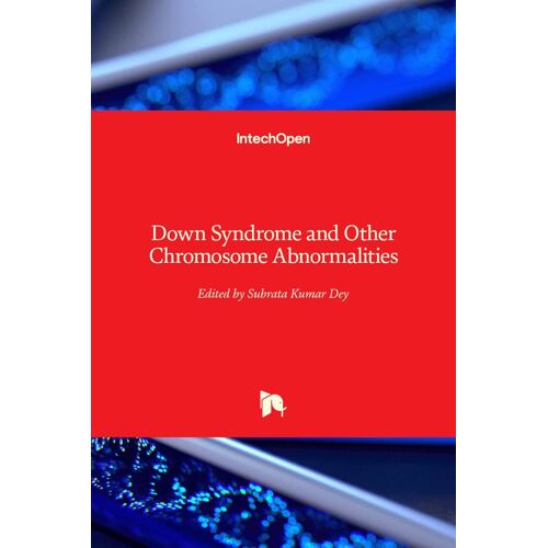 Down Syndrome And Other Chromosome Abnormalities