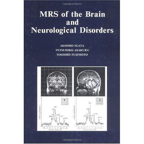 Mrs Of The Brain And Neurological Disorders