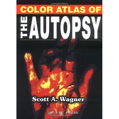 Color Atlas Of The Autopsy