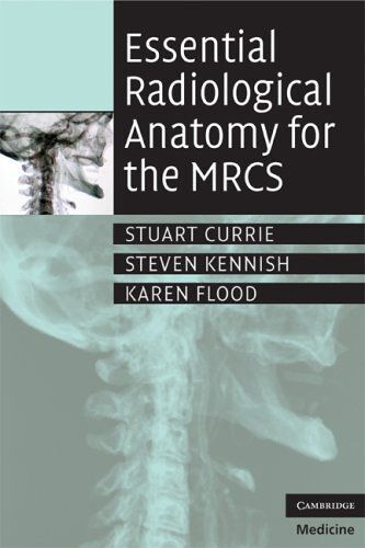 Essential Radiological Anatomy For The Mrcs