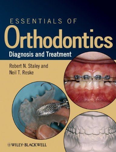 Essentials Of Orthodontics