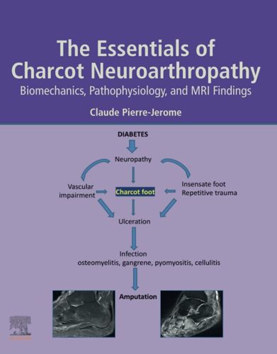 The Essentials Of Charcot Neuroarthropathy