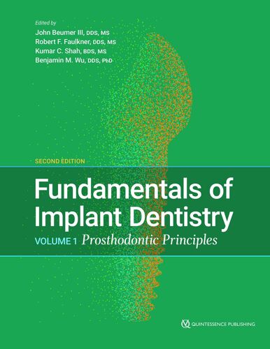 Fundamentals Of Implant Dentistry: Prosthodontic Principles (1)