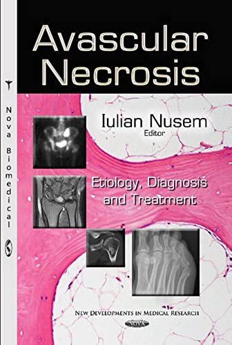 Avascular Necrosis (New Developments In Medical Research)