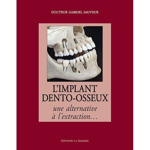 L'implant Dento-Osseux - Une Alternative À L'extraction