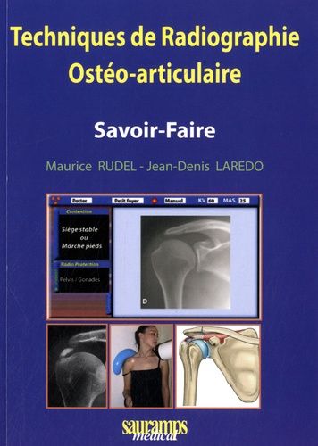 Techniques De Radiographie Ostéo-Articulaire - Savoir-Faire