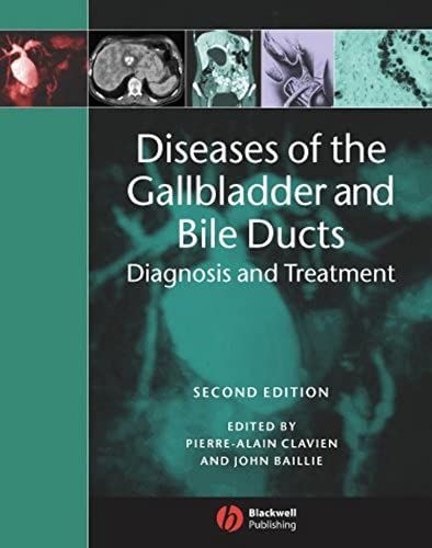 Diseases Of The Gallbladder And Bile Ducts