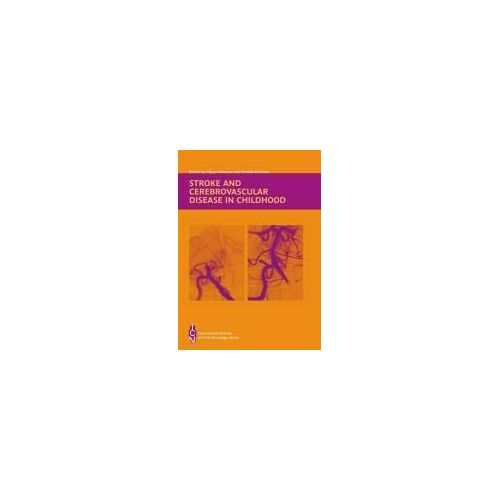 Stroke And Cerebrovascular Disease In Childhood