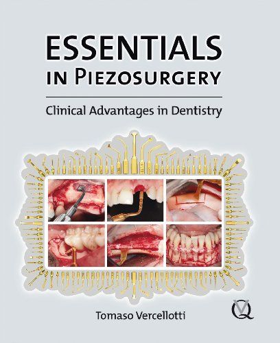 Essentials In Piezosurgery: Clinical Advantages In Dentistry