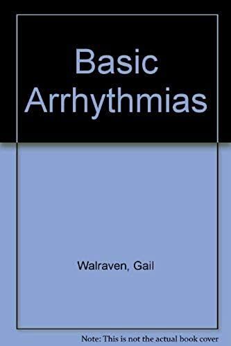 Basic Arrhythmias