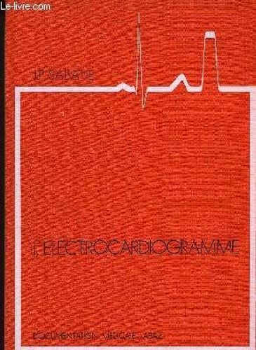 L'electrocardiogramme