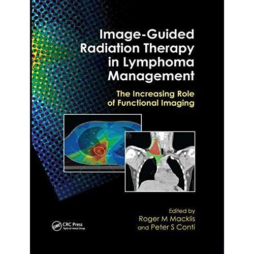 Image-Guided Radiation Therapy In Lymphoma Management