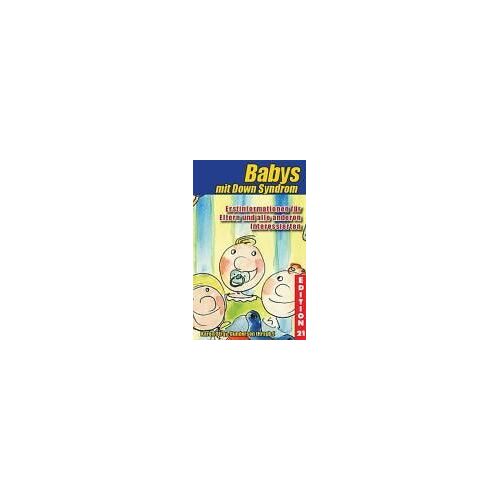 Babys Mit Down-Syndrom