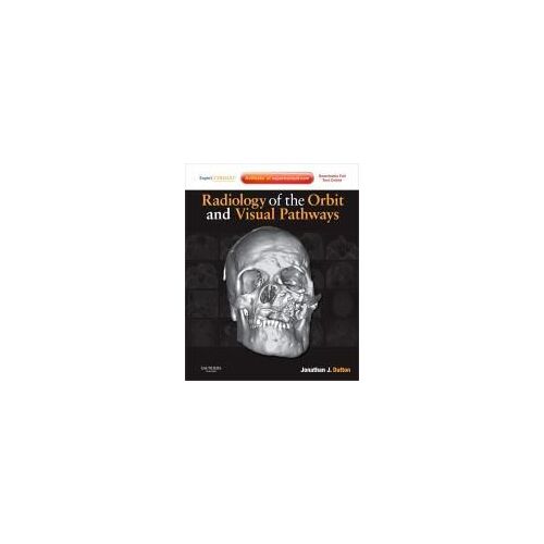 Radiology Of The Orbit And Visual Pathways
