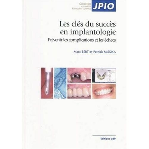 Les Clés Du Succès En Implantologie - Prévenir Les Complications Et Les Échecs