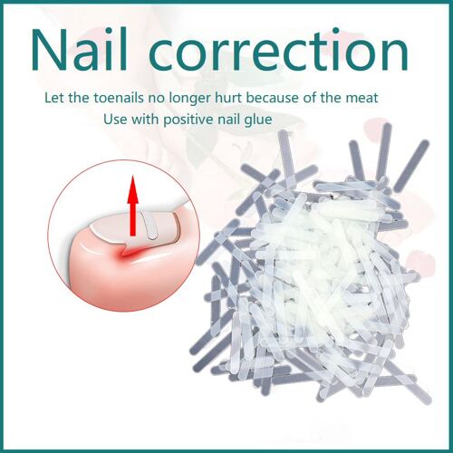 Xm 10 Pièces Incarné Orteil Outil De Correction Des Ongles Orteil Traitement Des Ongles Élastique Patch Autocollant Redressage Pince Orthèse Pédicure Outil 