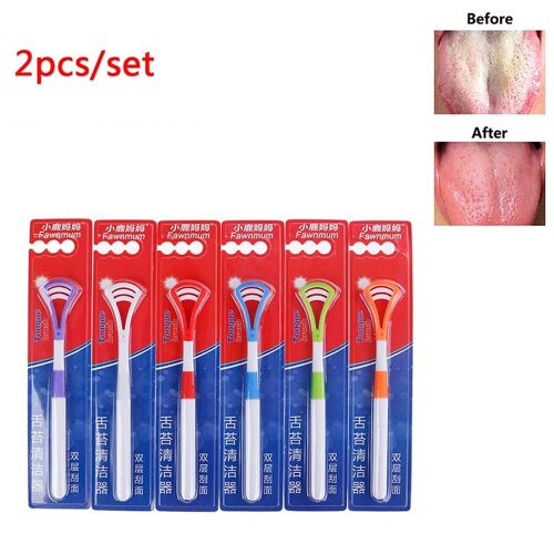 Xm 2 Pièces/Lot Plastique Langue Tounge Nettoyant Grattoir Soins Professionnel Hygiène Buccale Bouche Aléatoire Langue Nettoyant Grattoir 