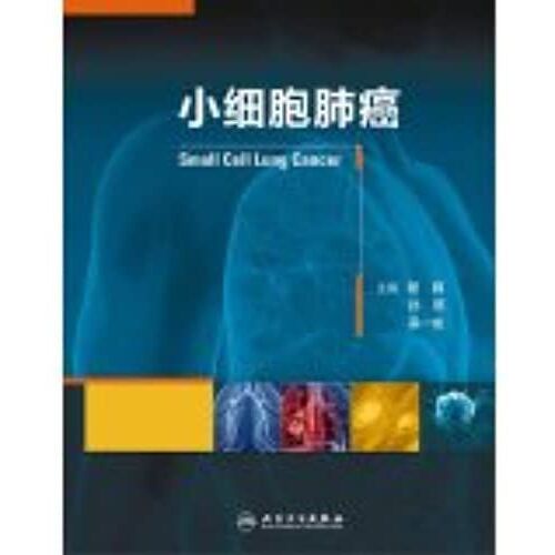 Small Cell Lung Cancer(Chinese Edition)