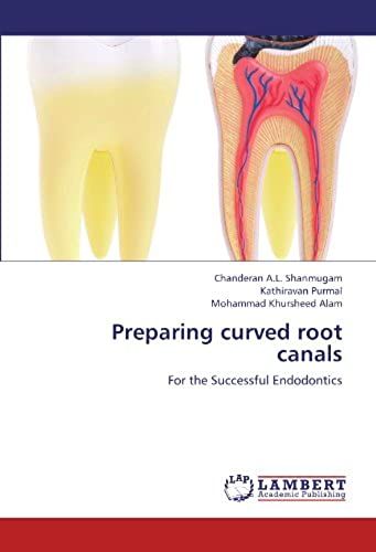 Preparing Curved Root Canals