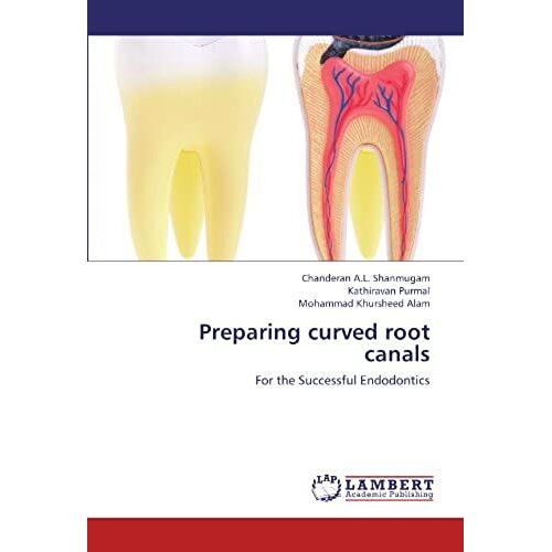 Preparing Curved Root Canals