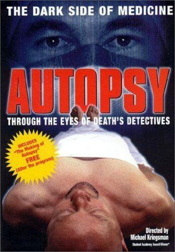 Autopsie