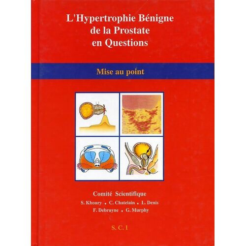 L'hypertrophie Benigne De La Prostate En Questions, Mise Au Point