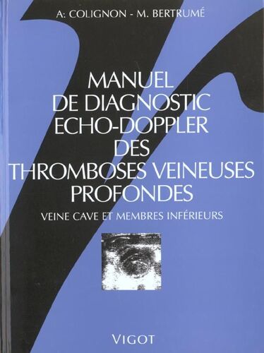 Manuel De Diagnostic Écho-Doppler Des Thromboses Veineuses Profondes - Veine Cave Et Membres Inférieurs