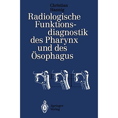 Radiologische Funktionsdiagnostik Des Pharynx Und Des Ösophagus